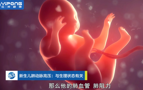小儿肺动脉高压究竟是什么病?